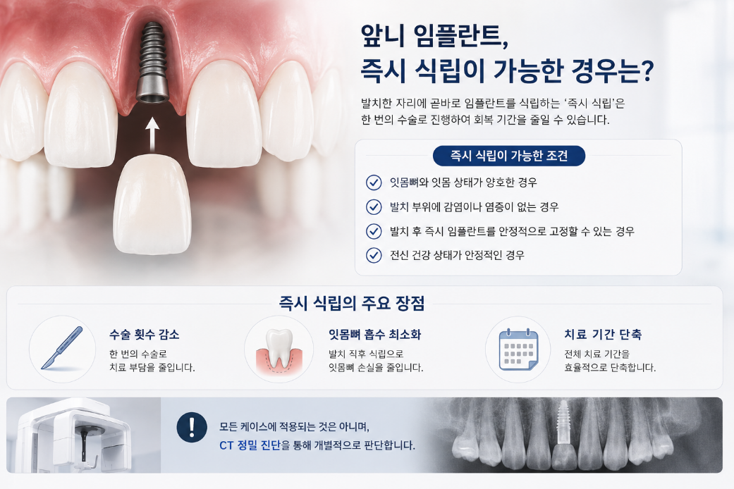 앞니 즉시 식립 임플란트 - 춘천 앞니 임플란트