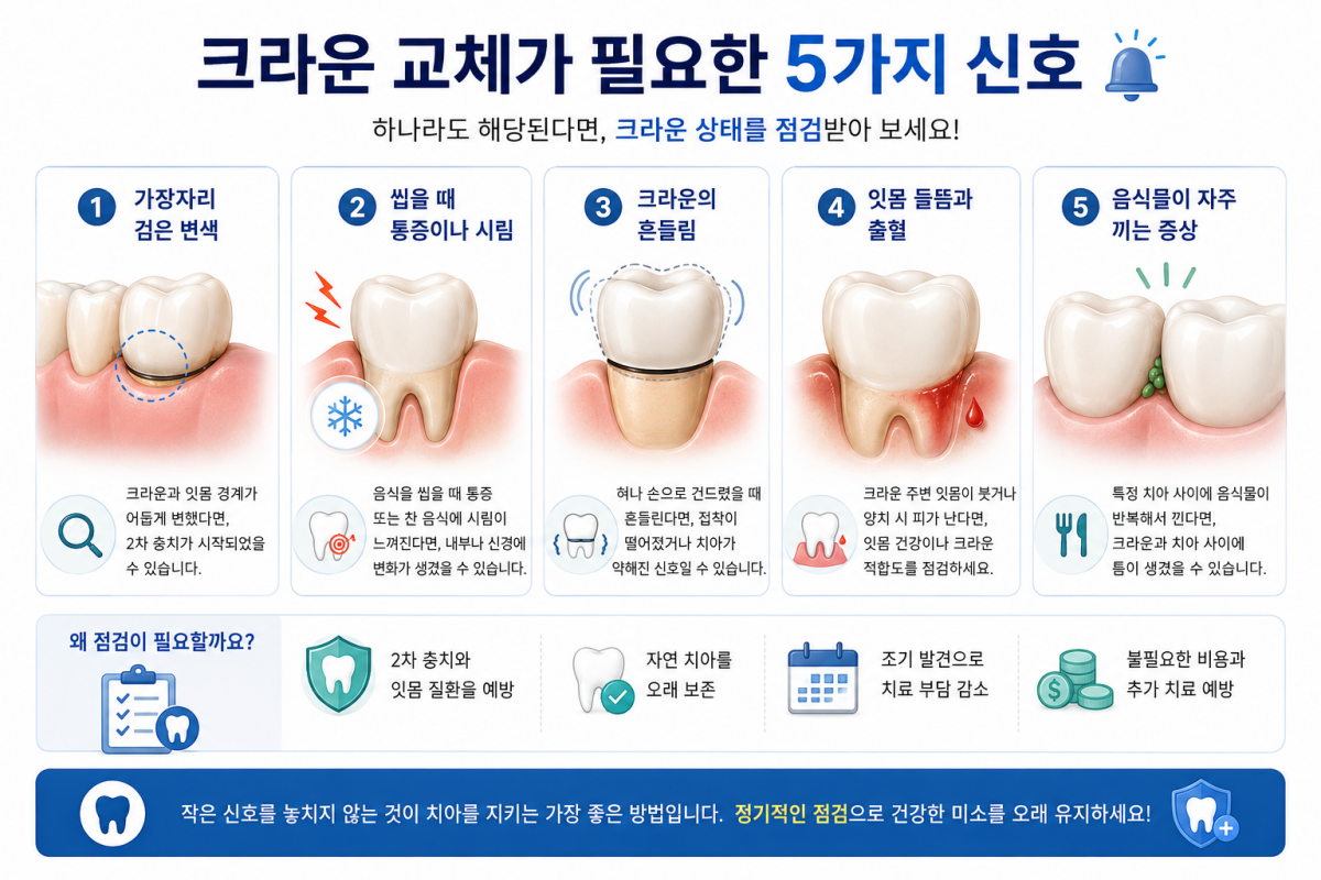 크라운 아래 2차 충치 진행 - 춘천서울부부치과