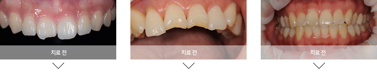 교정전