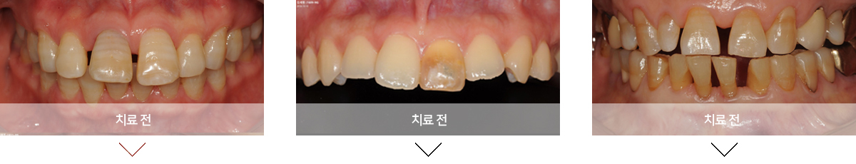 교정전