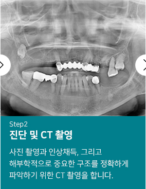 진단 및 CT 촬영