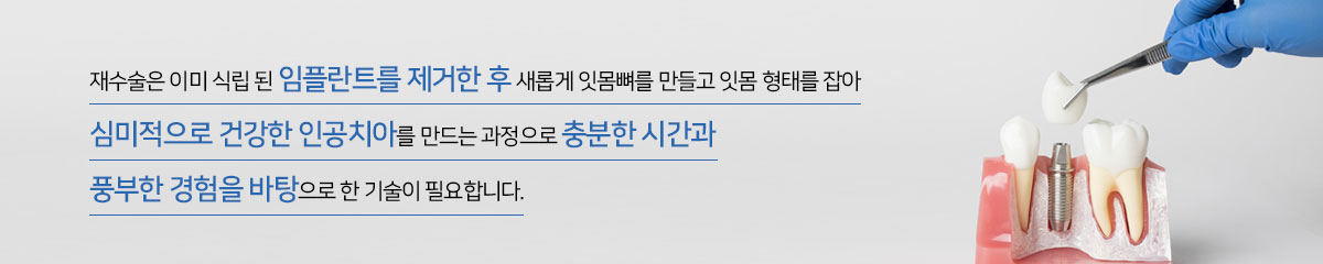 재수술은 이미 식립 된 임플란트를 제거한 후 새롭게 잇몸뼈를 만들고 잇몸 형태를 잡아 심미적으로 건강한 인공치아를
만드는 과정으로 충분한 시간과 풍부한 경험을 바탕으로 한 기술이 필요합니다.