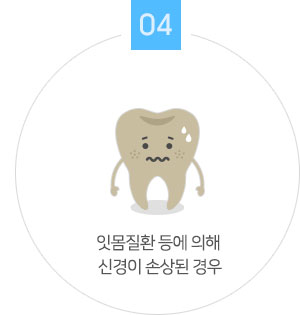 잇몸질환 등에 의해 신경이 손상된 경우