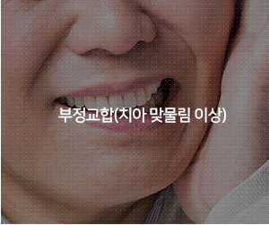 부정교합